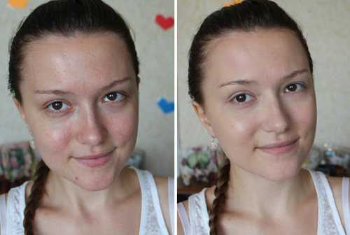 Идеальная кожа: как сделать кожу гладкой — средства, процедуры и советы дерматолога | vogue russia