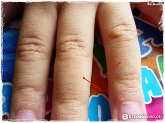 Привычка грызть ногти | блог медицинского центра "анапа-океан"
