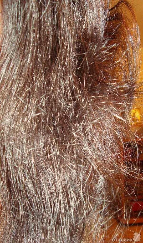Ломаются волосы [что делать] - 5 причин, почему волосы ломкие с середины, по всей длине и у корней