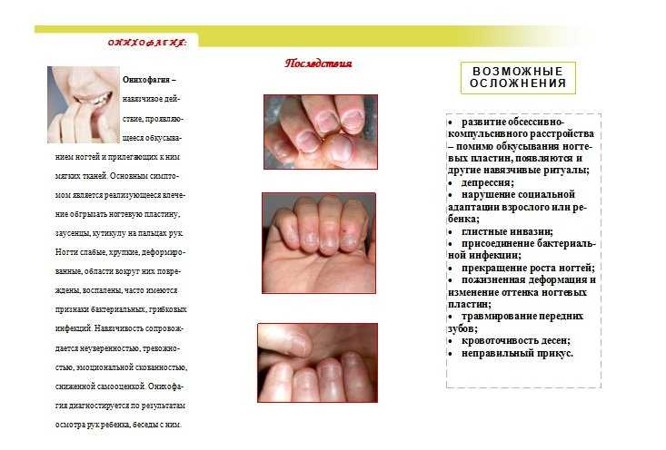 Как перестать грызть ногти и отрастить их — modnail.ru — красивый маникюр