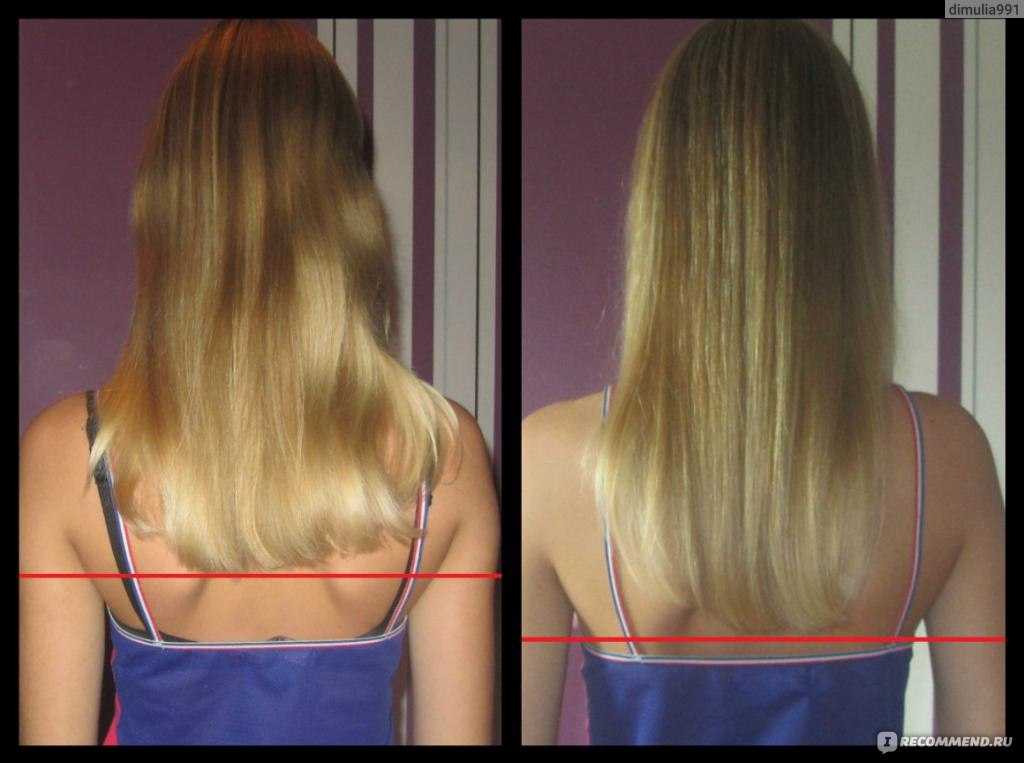 Метод инверсии для роста волос: описание и отзывы  — ruxa