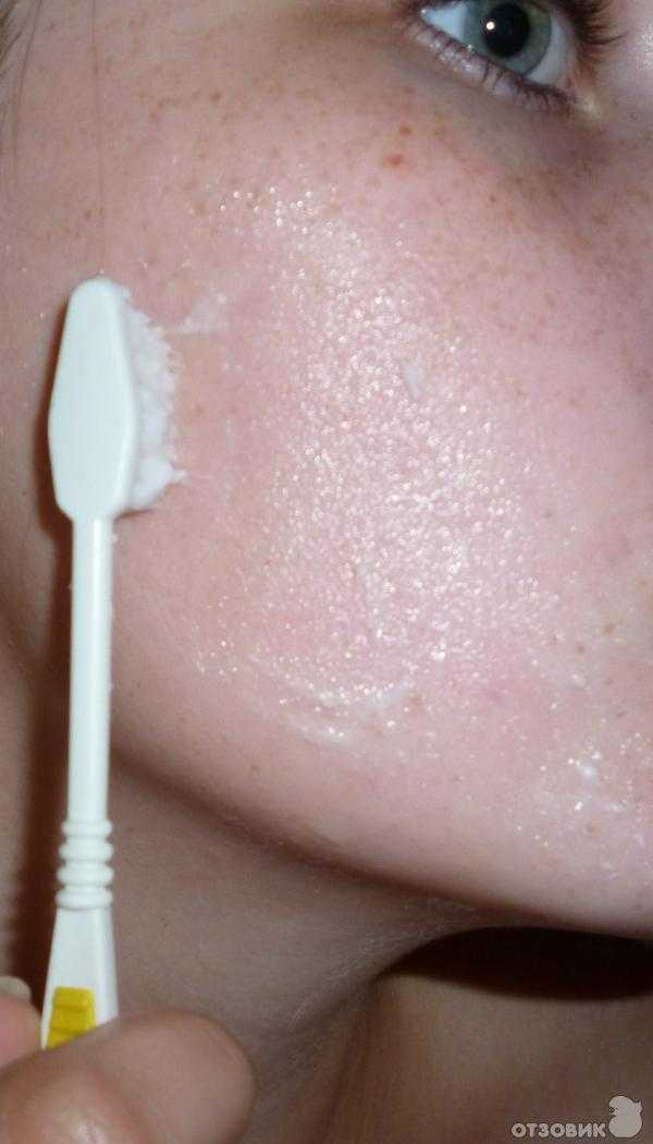 Эффективное очищение кожи лица с помощью глубокой чистки