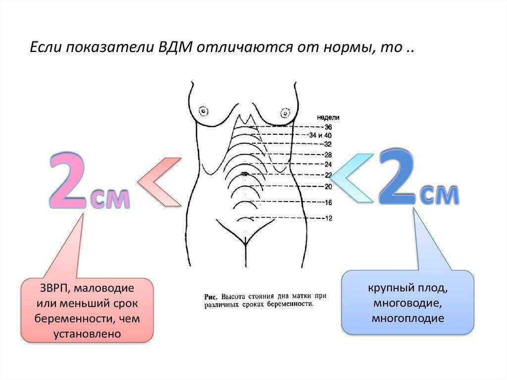 ᐉ как проходит измерение высоты стояния дна матки у беременной. как измеряется высота стояния дна матки и что означает этот показатель - ➡ sp-kupavna.ru