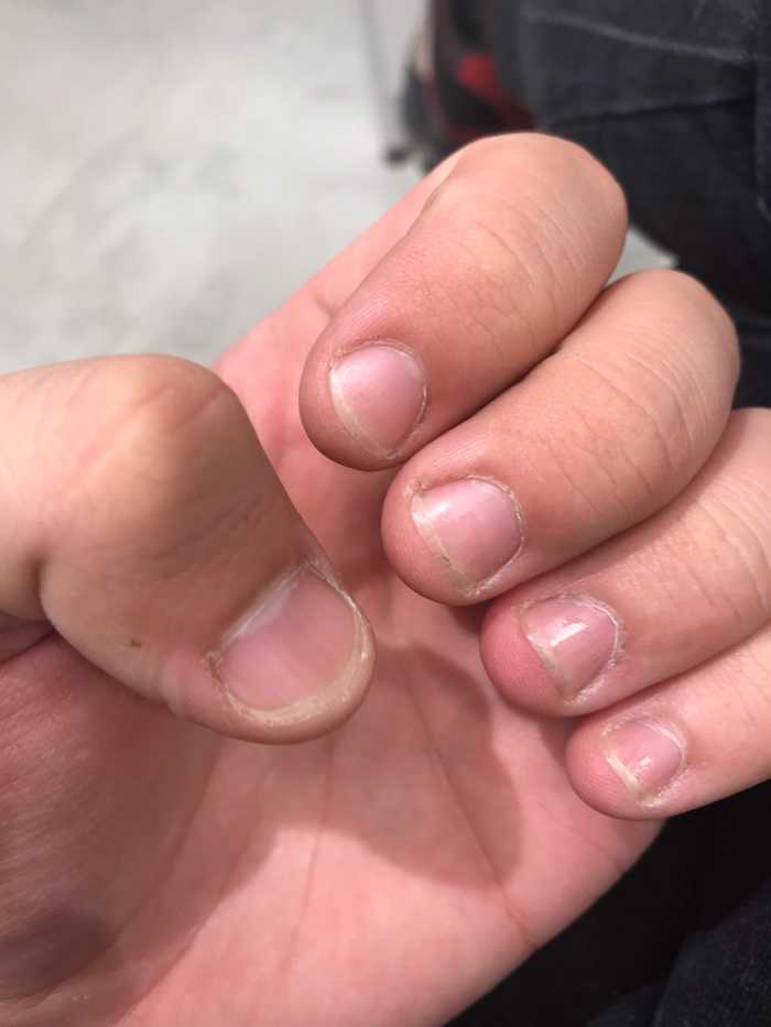 Как перестать грызть ногти и отрастить их