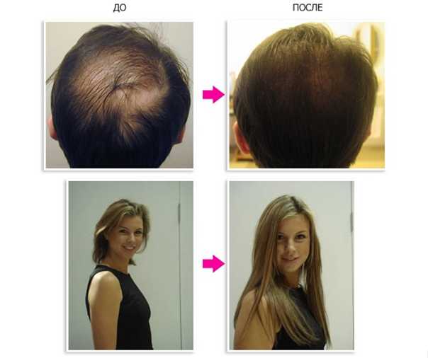 Метод инверсии для роста волос