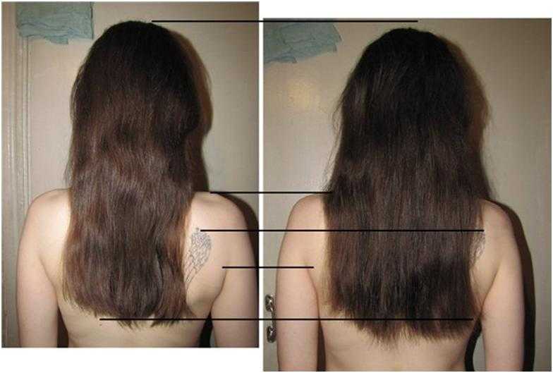 Метод инверсии для роста волос - отзывы с фото до и после, как делать процедуру