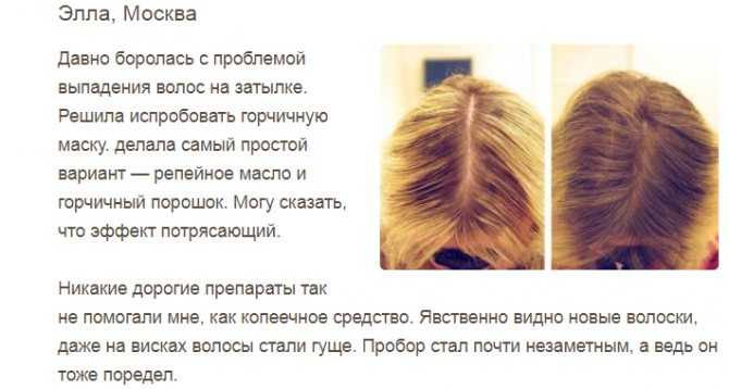 Метод инверсии для роста волос - отзывы с фото до и после, как делать процедуру - lipesinka.ru