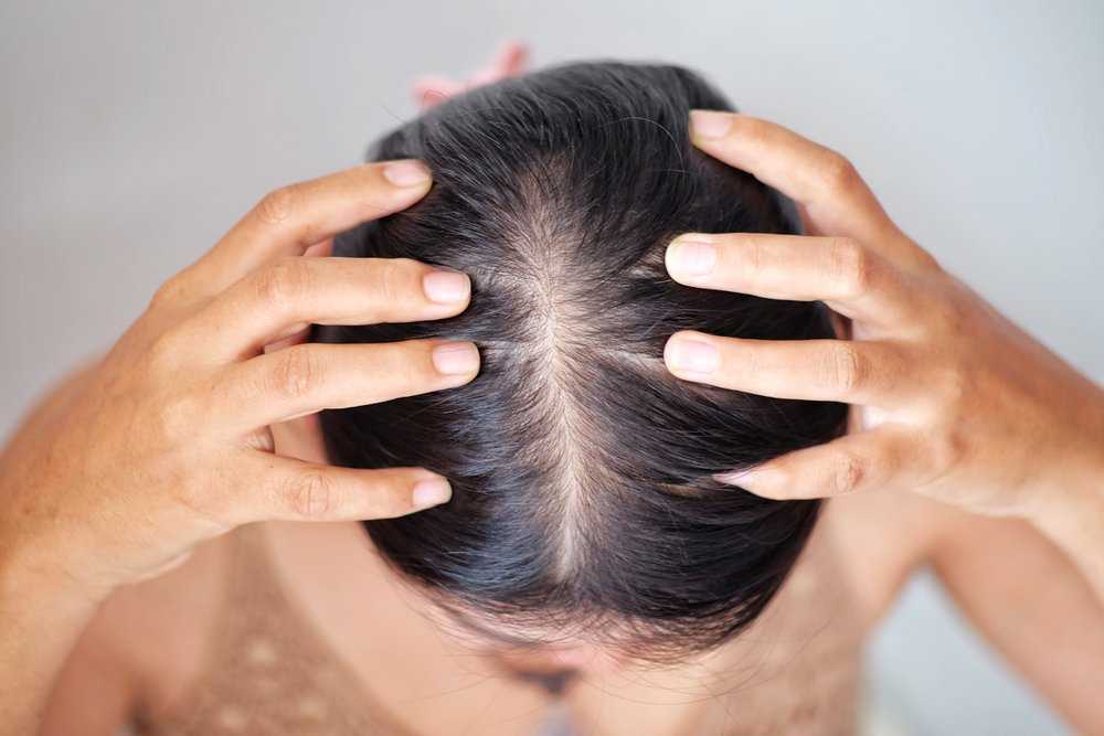 Без начёса: 9 способов, как быстро и эффективно добавить волосам объём