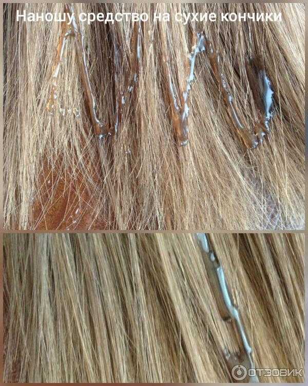 Выпадение волос у женщин – причины, лечение сильного выпадения