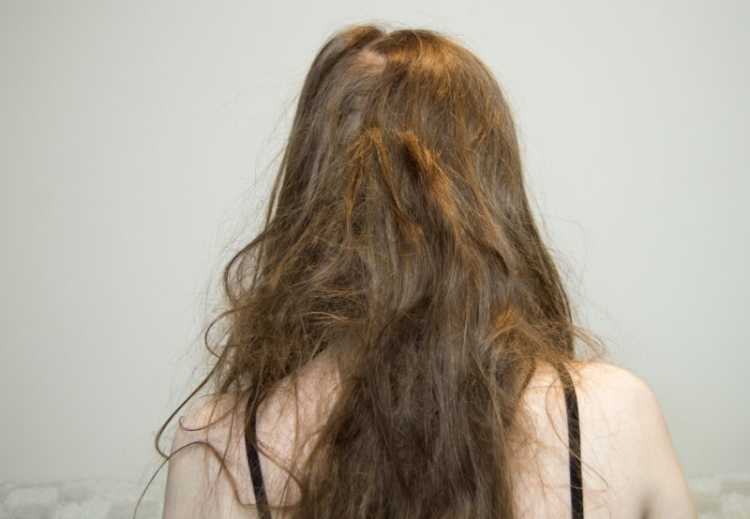 Как распутать большой колтун в волосах. как расчесать сильно запутанные волосы? сильно запутались длинные кончики волос на затылке и макушке: что делать
