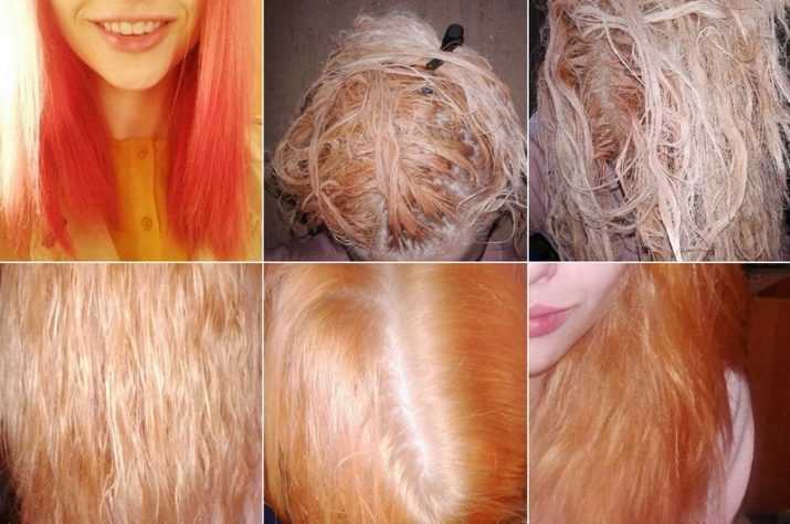 Осветление волос перекисью водорода: пошаговая инструкция, результаты, отзывы  — ruxa