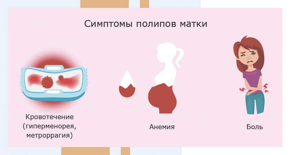 Как отличить месячные от кровотечения имплантационного и маточного
