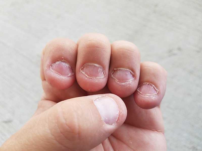 Как отучиться грызть ногти когда нервничаешь - советы для взрослых и детей